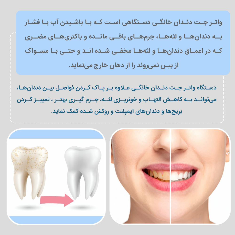 دستگاه واترجت شست و شوی دهان و دندان بنکس مدل M209