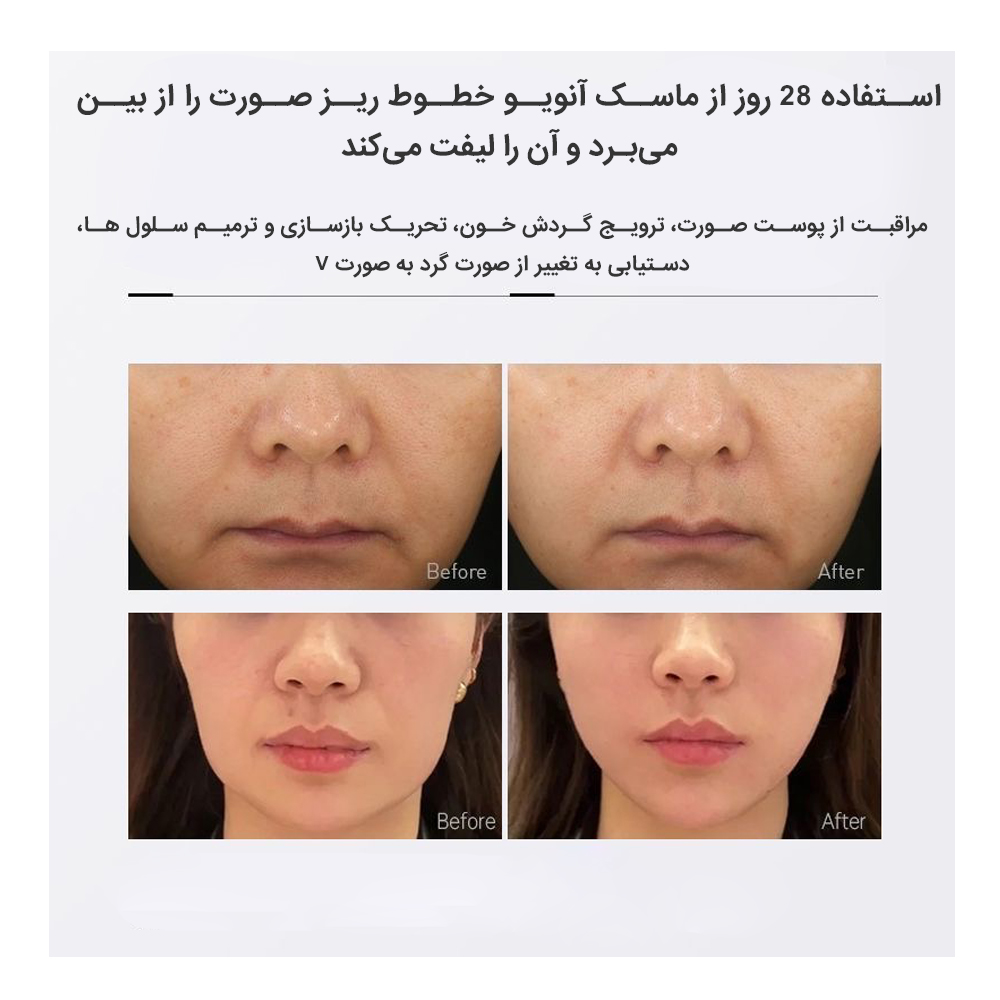 ماسک کانتورینگ صورت بنکس مدل Anwuyo